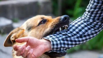 Алматинку укусила собака в Ботаническом саду: что ответили в организации