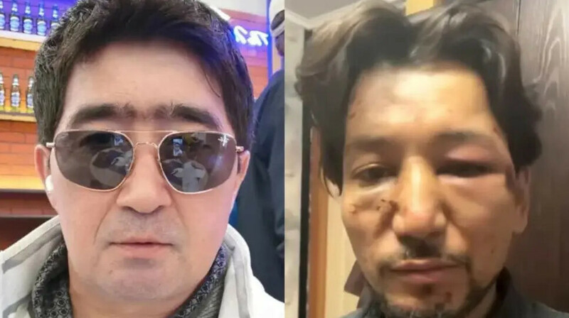 Скандал в “Нур-Мукасан”: участника избили из-за песни